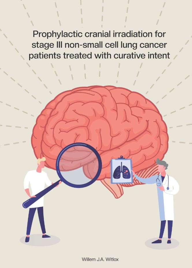 Profylactische hersenbestraling verlaagd het risico op hersenmetastasen bij stadium III long kanker