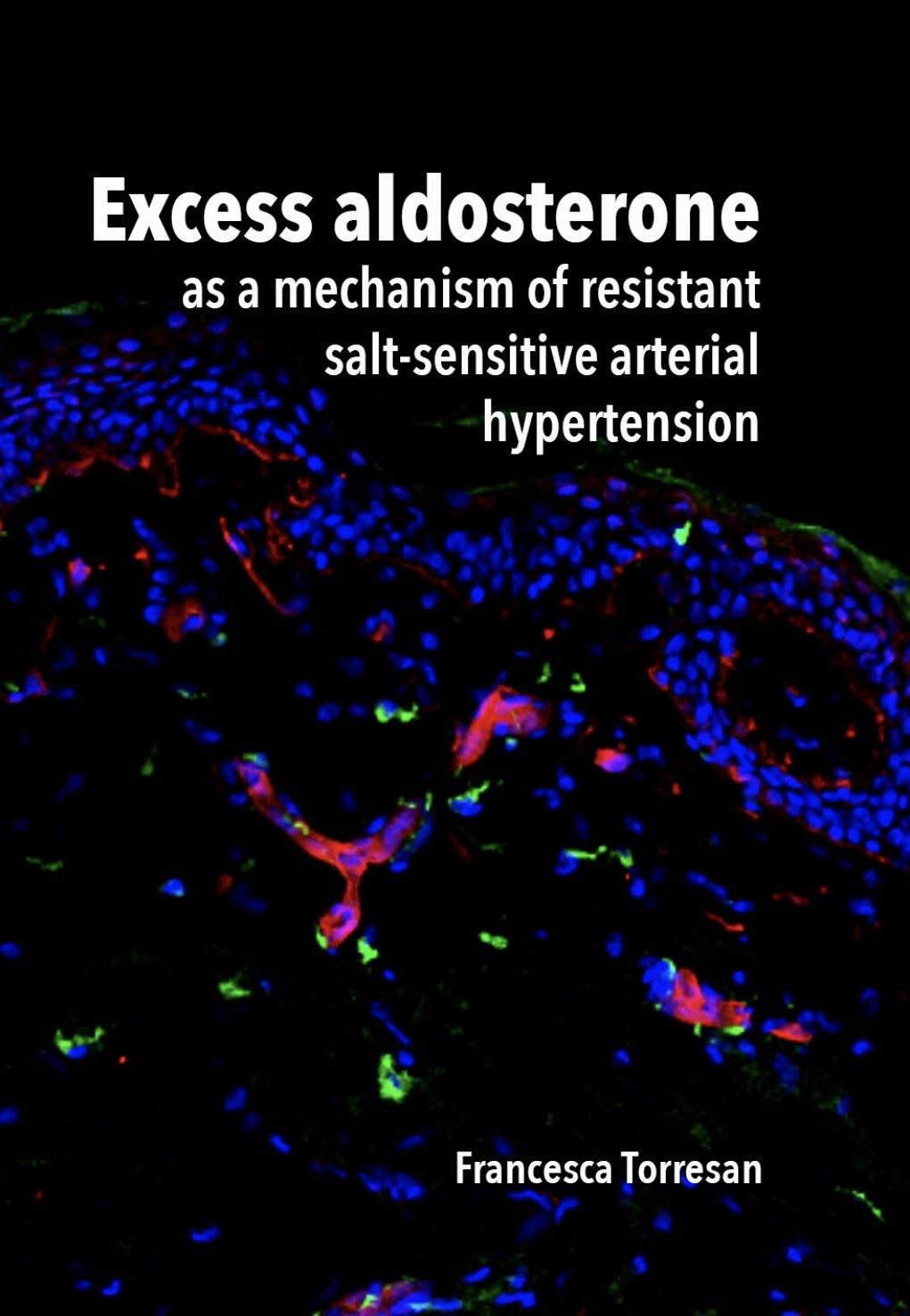 Overtollig aldosteron – nieuwe inzichten over zoutgevoelige arteriële hypertensie