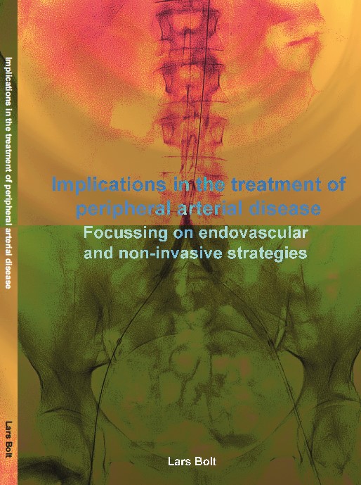 Succesvolle innovatieve benadering in de preventie van nierschade bij endovasculaire interventies