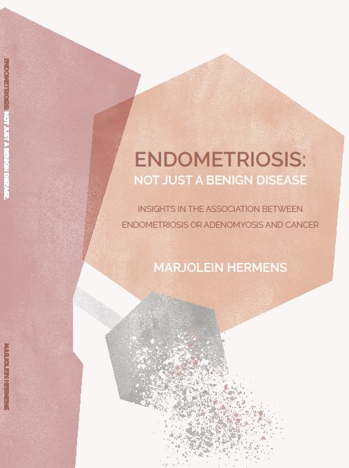Associatie tussen eierstok- en baarmoederkanker en vormen van endometriose of adenomyose